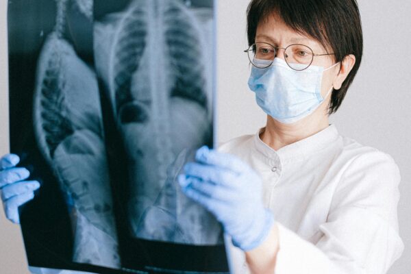 Medical professional in PPE examining chest X-ray results for diagnosis.